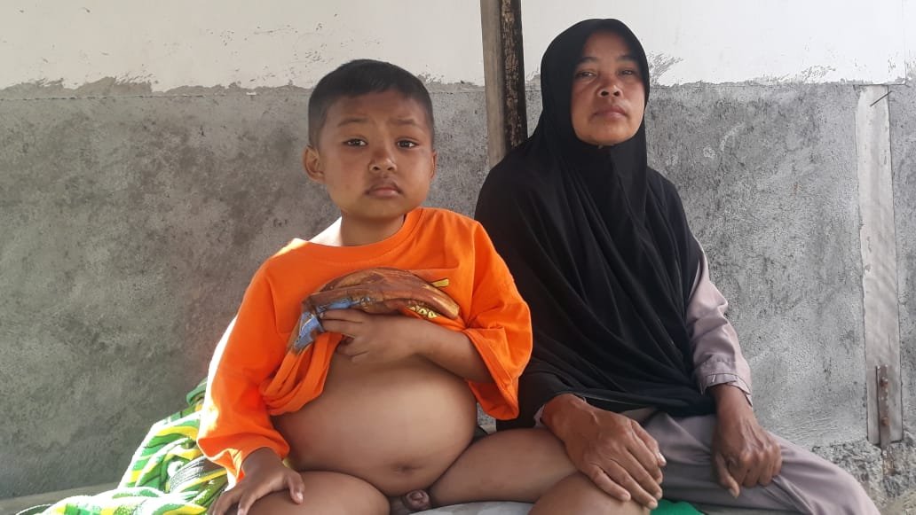 Bocor Jantung Bocah Delapan Tahun dari Sembalun  Butuh Biaya Pengobatan