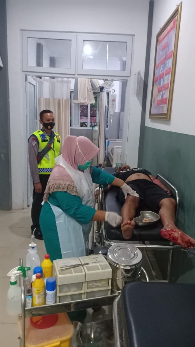 Sepeda Motor Cium Aspal di Jalur Teluk Kombal, Muhamad Warga Kediri Mengalami Luka Parah