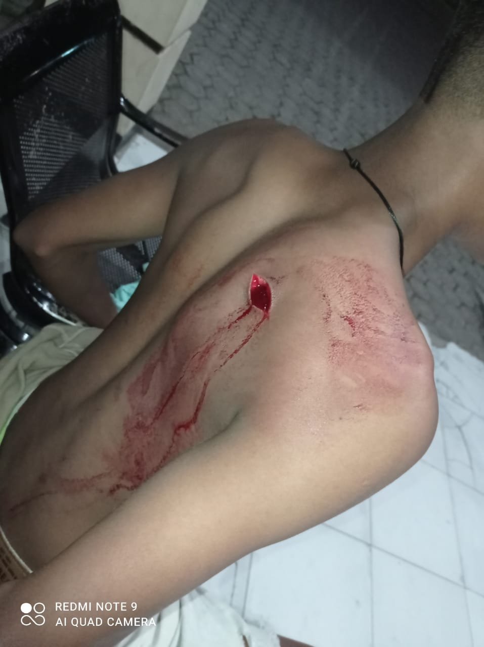 Cemburu Mantannya Dipacari Korban, Tiga Remaja di Dompu Keroyok dan Bacok Muhamad Riadi