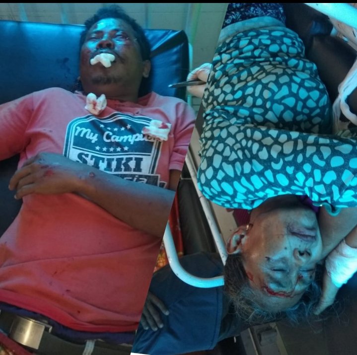 Tabrak Nenek Pelintas Jalan, Pengendara Motor dan Korban Luka Parah