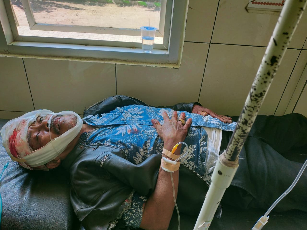 Honda Hantam Dum Truk, Pengendara Motor Luka Berat Dilarikan ke RSUD Praya