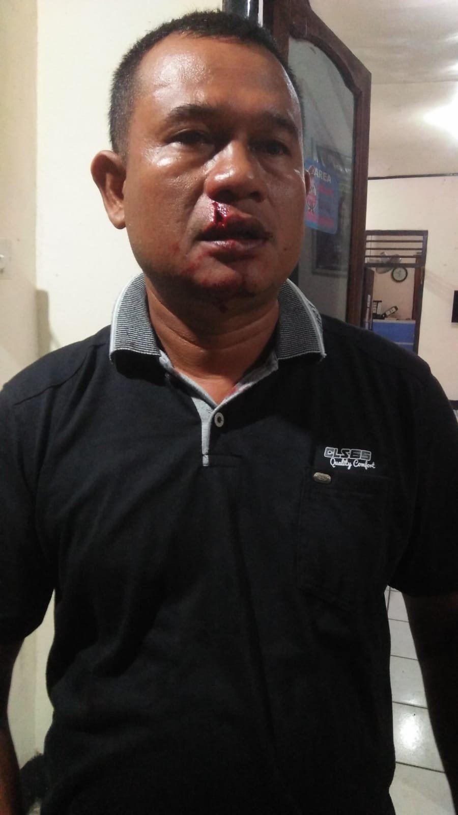 Bibir Pak RT di Sumbawa Barat Nyonyor Dibogem Pemuda Mabok