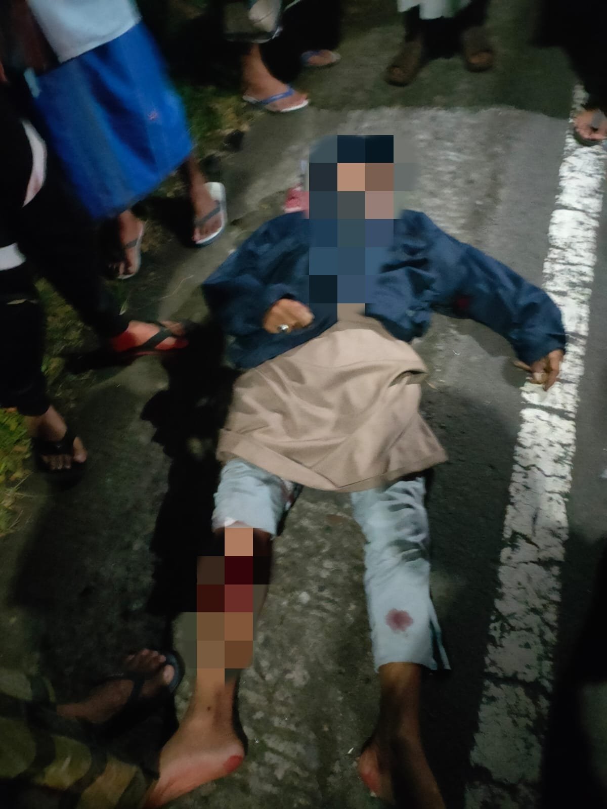 Lagi Tabrakan Maut di Wilayah Hukum Polres Lombok Tengah, Satu Orang Pengendara Motor Tewas