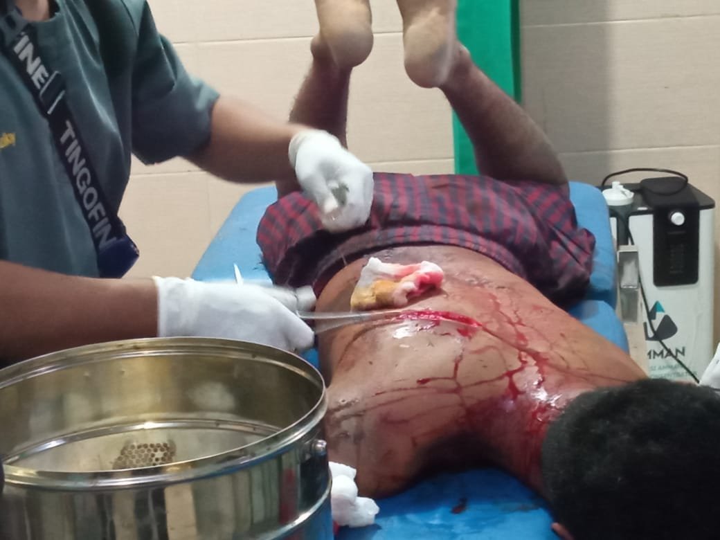 Polisi Buru Pelaku Pembacokan Warga Kendai Dua Dompu