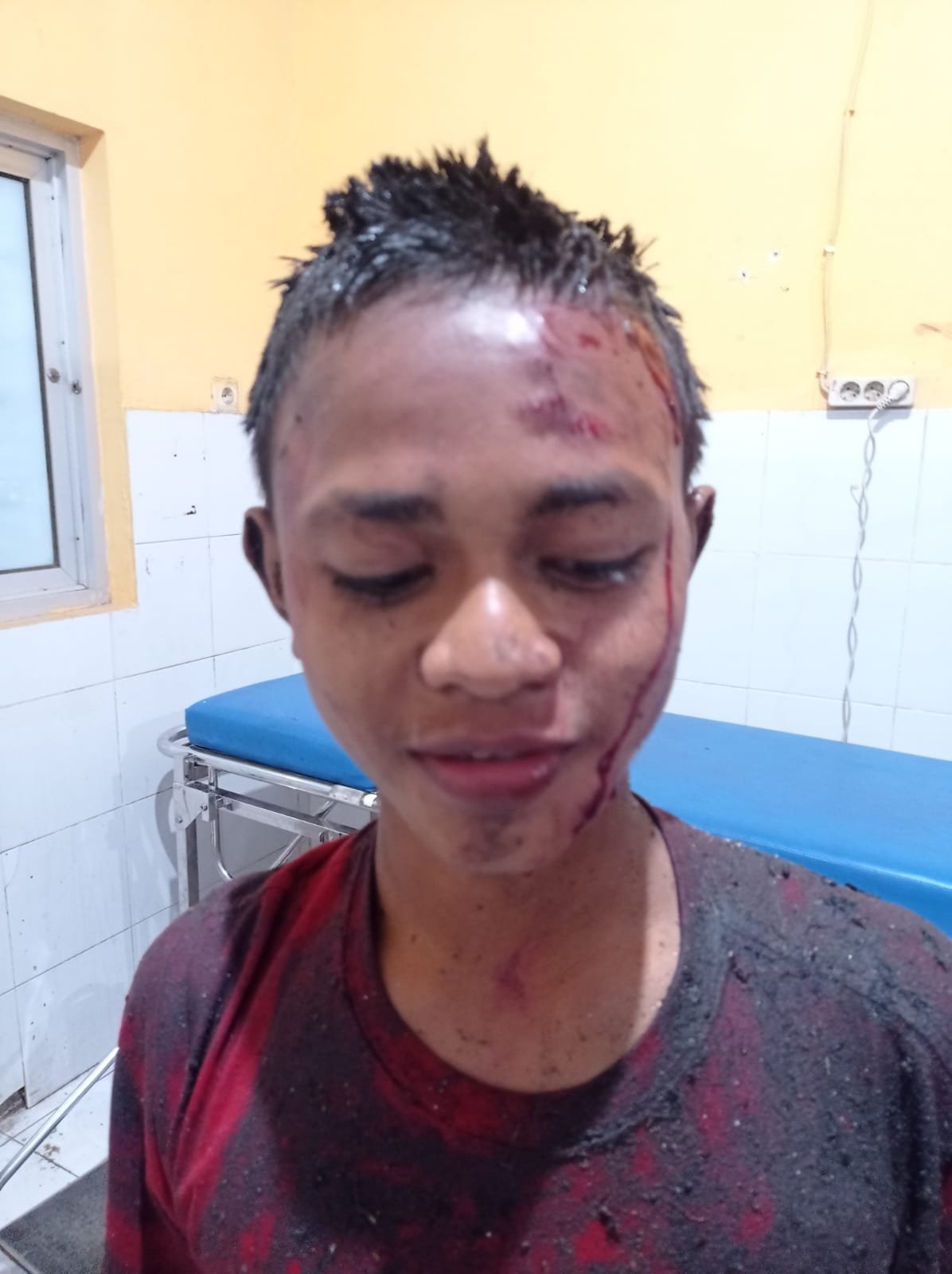 Aksi Senggol Sepeda Motor, Tiga Remaja Berboncengan Tiga Cium Aspal