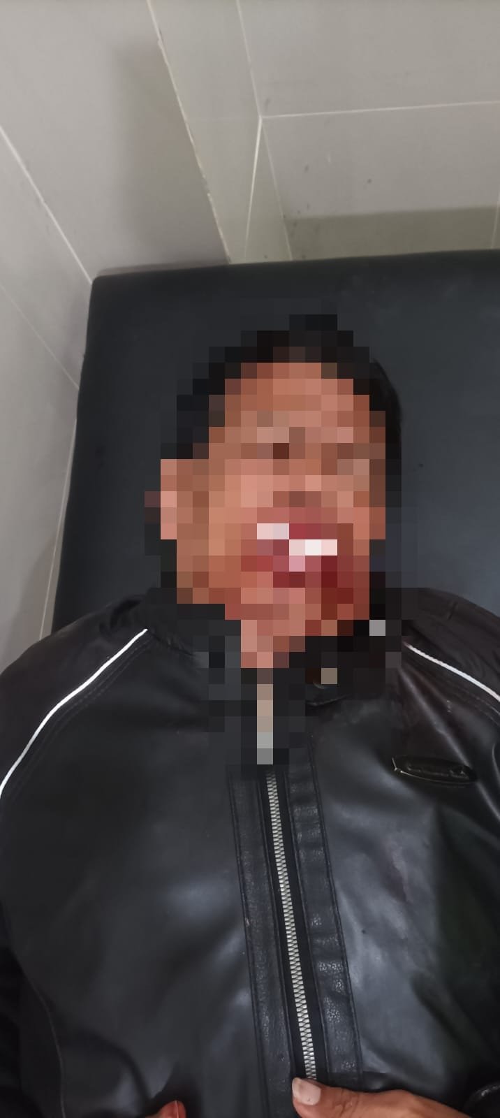 Cium Bumper Dum Truk, Pengendara Motor Terpelanting dan Luka Parah